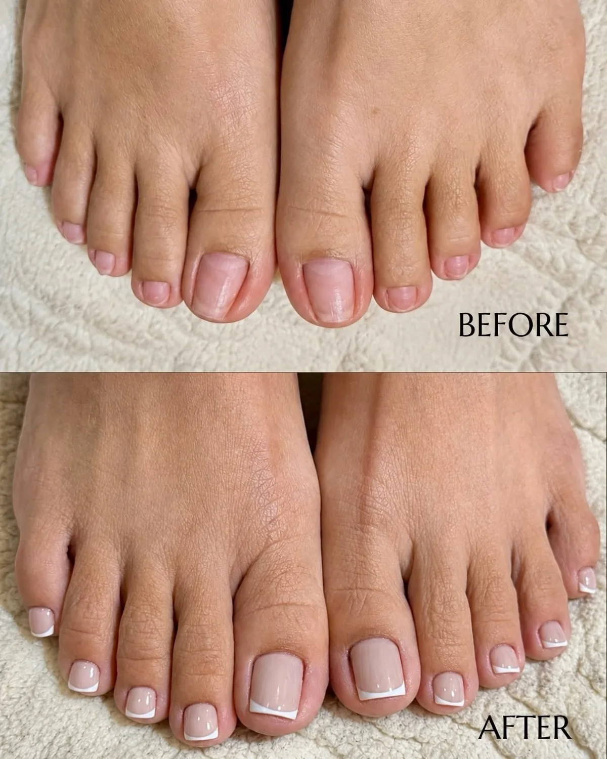 before and after nail reconstruction with a natural French tip pedicure finish, AyuriNails Beauty Lounge Makati